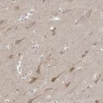 Gephyrin Antibody in Immunohistochemistry (IHC)