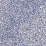 Gephyrin Antibody in Immunohistochemistry (IHC)