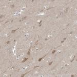 Gephyrin Antibody in Immunohistochemistry (IHC)