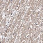 FHOD3 Antibody in Immunohistochemistry (IHC)