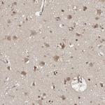 FHOD3 Antibody in Immunohistochemistry (IHC)