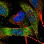 MPP3 Antibody in Immunocytochemistry (ICC/IF)