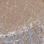 MPP3 Antibody in Immunohistochemistry (Paraffin) (IHC (P))