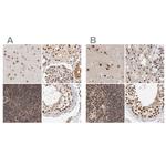 ZNF830 Antibody in Immunohistochemistry (IHC)