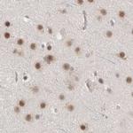 ZNF830 Antibody in Immunohistochemistry (IHC)