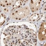 ZNF830 Antibody in Immunohistochemistry (IHC)