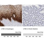 LY6D Antibody in Immunohistochemistry (IHC)