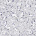 LY6D Antibody in Immunohistochemistry (IHC)