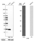 LY6D Antibody in Western Blot (WB)