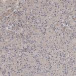 OTUD6B Antibody in Immunohistochemistry (IHC)