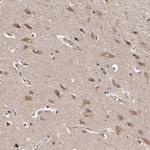 VPS37A Antibody in Immunohistochemistry (Paraffin) (IHC (P))