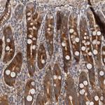 VPS37A Antibody in Immunohistochemistry (Paraffin) (IHC (P))