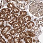 VPS37A Antibody in Immunohistochemistry (Paraffin) (IHC (P))