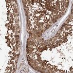 VPS37A Antibody in Immunohistochemistry (IHC)