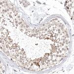 KIF2B Antibody in Immunohistochemistry (Paraffin) (IHC (P))