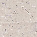 KIF2B Antibody in Immunohistochemistry (Paraffin) (IHC (P))