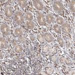 KIF2B Antibody in Immunohistochemistry (Paraffin) (IHC (P))