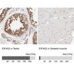 eIF4G3 Antibody in Immunohistochemistry (IHC)