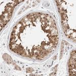 eIF4G3 Antibody in Immunohistochemistry (IHC)