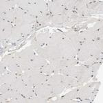 eIF4G3 Antibody in Immunohistochemistry (IHC)