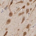 eIF4G3 Antibody in Immunohistochemistry (IHC)