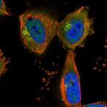 KLHL20 Antibody in Immunocytochemistry (ICC/IF)