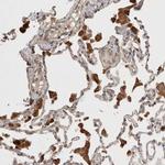 KLHL20 Antibody in Immunohistochemistry (Paraffin) (IHC (P))