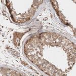 KLHL20 Antibody in Immunohistochemistry (Paraffin) (IHC (P))