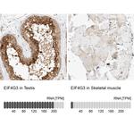 eIF4G3 Antibody in Immunohistochemistry (IHC)