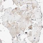 eIF4G3 Antibody in Immunohistochemistry (IHC)