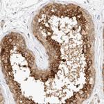 eIF4G3 Antibody in Immunohistochemistry (IHC)