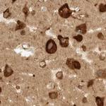 eIF4G3 Antibody in Immunohistochemistry (IHC)