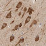 eIF4G3 Antibody in Immunohistochemistry (IHC)