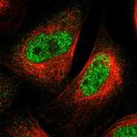 SPRTN Antibody in Immunocytochemistry (ICC/IF)