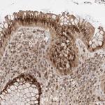 MAN1 Antibody in Immunohistochemistry (IHC)