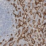 RAB32 Antibody in Immunohistochemistry (Paraffin) (IHC (P))