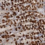 EDEM3 Antibody in Immunohistochemistry (IHC)