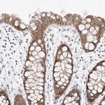 MRPL37 Antibody in Immunohistochemistry (IHC)