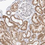 MRPL37 Antibody in Immunohistochemistry (IHC)