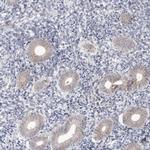 MRPL37 Antibody in Immunohistochemistry (IHC)