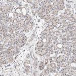 MRPL37 Antibody in Immunohistochemistry (IHC)