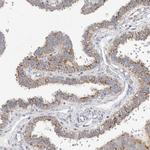 ELP3 Antibody in Immunohistochemistry (IHC)