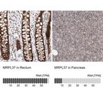 MRPL37 Antibody in Immunohistochemistry (IHC)