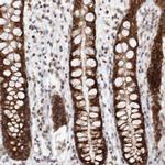 MRPL37 Antibody in Immunohistochemistry (IHC)