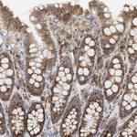 Ribophorin II Antibody in Immunohistochemistry (Paraffin) (IHC (P))