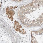 Ribophorin II Antibody in Immunohistochemistry (Paraffin) (IHC (P))