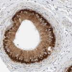 Ribophorin II Antibody in Immunohistochemistry (IHC)