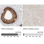 Ribophorin II Antibody