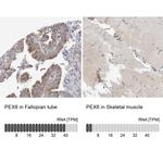 PEX6 Antibody in Immunohistochemistry (IHC)