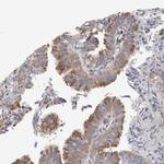 PEX6 Antibody in Immunohistochemistry (IHC)